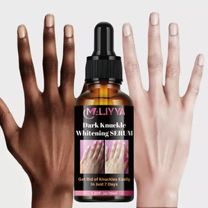 Solo 7 días, nudillos de mano, negro, elimina el Corrector, suero blanqueador de nudillos blanco y oscuro - Product Image 5