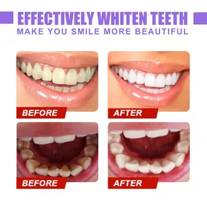 Logo personalizzato sbiancamento rapido paradenti correttore di colore V34 dentifricio sbiancante per denti per sorriso sicuro