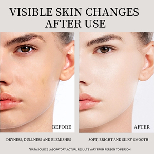 Cao Hiệu Quả Kiểm Soát Dầu Trắng Trà Nhẹ Nhàng Làm Sạch Ánh Sáng Làm Trắng Mặt Rửa Không Căng thẳng Tẩy Tế Bào Chết Mặt Rửa Cho Da Dầu - Product Image 5