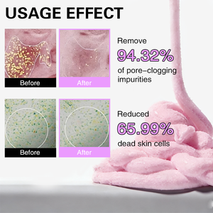 Nettoyant Fouetté ZS PDRN Niacinamide – Nettoyage Quotidien Doux, Hydratant et Nourrissant, Soin des Pores et Teint Irrégulier – Coréen - Product Image 5