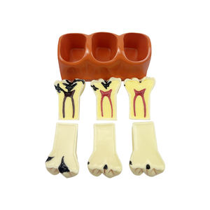 Modèles de comparaison des caries (4 fois grandis), Modèle de dents décomposées pour l'enseignement, la <span class=keywords><strong>recherche</strong></span> et l'étude en dentisterie pour étudiants - Product Image 5