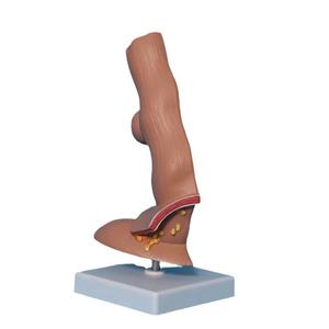 Modelo Anatómico del Esófago del Sistema Digestivo para Entrenamiento Médico MAXCARE MAC-YJ84 para Hospitales y Centros de Enseñanza - Product Image 1