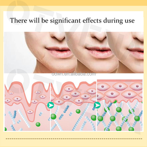 OTVENA Beste Anti-Aging Peptid-Creme Private Label Natürlich 100% Effektive Straffende Gesichtscreme Vegan Bio für Alle Hauttypen - Product Image 6