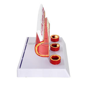 Медицинские науки, возрастные сосудистые изменения ишемической болезни сердца, тромбоз, Липиды и холестерин в крови человека - Product Image 4