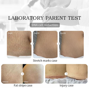 Crème Douce Non Irritante à la Rose pour Éliminer les Vergetures PDRN, Anti-rides, Anti-âge, Réparation Cutanée Post-Grossesse, Élimine les Cicatrices de Grossesse - Product Image 4