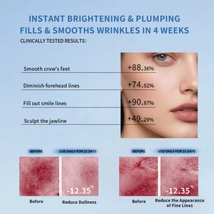 OEM kelas medis 5ml perawatan kulit wajah untuk Esens <span class=keywords><strong>Serum</strong></span> kolagen asam Hyaluronic rol kulit untuk Microneedling salon kecantikan - Product Image 6