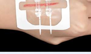 مجموعة إغلاق جروح طوارئ شفافة ضمادات فراشة وتضميد شريط خياطة للتمزق وشقوق - Product Image 3