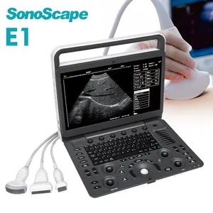 SonoScape 휴대용 초음파 기계 초음파 SonoScape E1