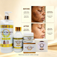 Kit de Blanchiment des Jointures OEM – Correcteur de Teint Foncé pour les Jointures, Soin Éclaircissant pour la Peau, Élimine les Taches Sombres, Ensemble de Beauté pour Blanchir les Coudes et les Genoux
