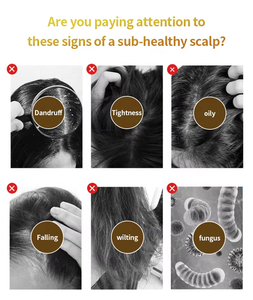 Detektor ozon pertumbuhan rambut HD, untuk penggunaan di rumah Salon 5 dalam 1 penganalisa kulit kepala frekuensi tinggi profesional - Product Image 6