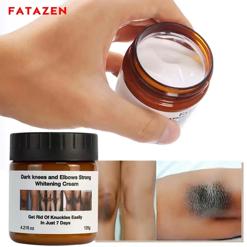 Crema idratante sbiancante pelle nera Blanchissante Visage Cremas Faciales Clareador Hidratante Aclaradora Cuidado De La Piel