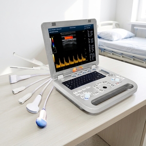 Échographe portable couleur <span class=keywords><strong>Doppler</strong></span> 128 éléments pour examen cardiovasculaire – Nouvelle génération - Product Image 6