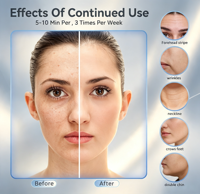 Sculpteur facial portable 7 en 1 à micro-courant ABS, masseur haute fréquence pour le visage et le cou, rechargeable par USB pour le lifting du visage