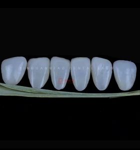 Naturel à la recherche de Max tous les placages de porcelaine céramique pont de <span class=keywords><strong>couronne</strong></span> avec coût de laboratoire <span class=keywords><strong>dentaire</strong></span> - Product Image 6