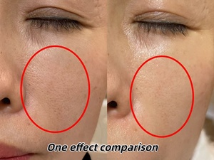 Vẻ đẹp chuyên nghiệp Salo Bio micro kim rong biển chăm sóc da thủy phân Sponge spicules microneedling gel + da sửa chữa huyết thanh - Product Image 4