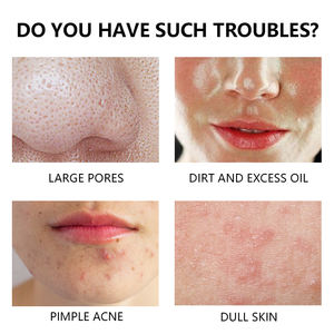 Ensemble de soins de la peau blanchissant antioxydant anti-âge de marque privée visage crème au peroxyde de benzoyle gel tonique nettoyant pour la prévention de l'acné - Product Image 3