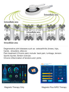 Máquina de Terapia de Anillo Magnético de Inducción de Alta Energía Mejorada para Alivio del Dolor Corporal, Portátil, de ABS, para Protección del Tejido Muscular y Óseo - Product Image 4