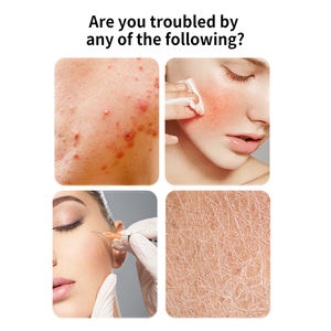 Spray de apósito líquido médico OEM/ODM |   Película Protectora de la Barrera Cutánea |   Cuidado de heridas no pegajoso para uso hospitalario y doméstico - Product Image 2