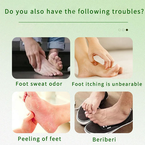 Grosir krim dan semprotan kaki anti-gatal: cepat meringankan rasa sakit, dan menggunakan bahan alami untuk menangani infeksi jamur - Product Image 5