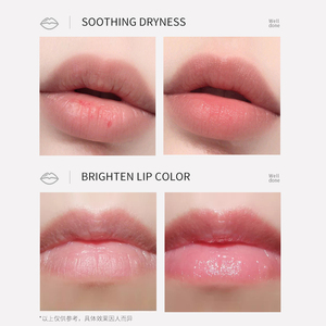 Bálsamo Labial BEOTUA Anti Resequedad, Impermeable, Reparador, Hidratante y Nutritivo con Menta, Aloe Vera, Limón, Miel, Durazno y Fresa - Product Image 5