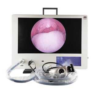 JOYMED, Endoscopio Médico Integrado, Diagnóstico Urológico, Cirugía, Imagen HD Clara, 24 Pulgadas, Fuente de Energía Eléctrica Todo en Uno - Product Image 5