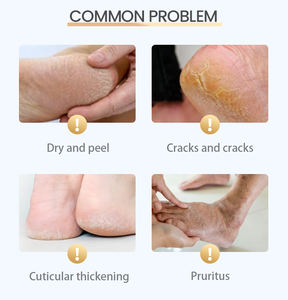 Fabrika Kalitesinde Çay Ağacı Ayak Maskesi, Ayak Bakımı için Hyaluronik Asit İçeren Nemlendirici Formül - Product Image 3