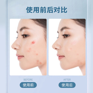 Pansement hydrocolloïde médical Haier, boîte de 36 pièces, pansement adhésif acrylique pour les coupures et abrasions mineures - Product Image 5