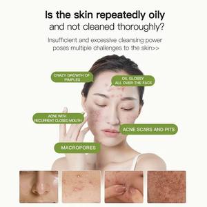 Crème Hydratante Visage Icesea Tea Tree 50ml Peaux Grasses à Tendance Acnéique Contrôle du Sébum Anti-Acné Non Comédogène Réduit les Imperfections Marque Privée - Product Image 4