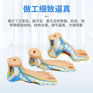 Modèle de pied normal, modèle de pied plat, modèle de genou arqué, modèle de pathologie du pied, modèle d'anatomie musculaire du pied humain - Product Image 5