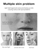 Masque Facial de Beauté Éclaircissant Hydratant Profond Moika, Fabricant Direct, à l'Orange, VC, Aloès et Hyaluronate de Sodium pour une Peau Douce