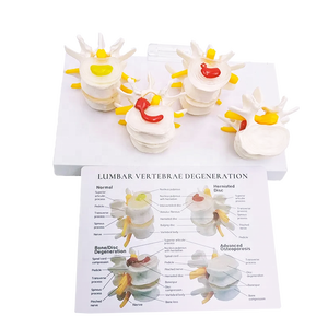 Tussenwervelschijf Degeneratie Osteoporose Model Lumbale Hernia Model Normale Plastic Lumbale Wervelkolom Model - Product Image 2