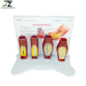 Modelo de Vasos Sanguíneos Humanos para Educación Médica, Equipo de Enseñanza de Anatomía - Product Image 2