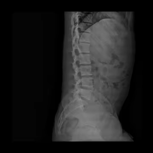 Iray không dây MARS 1417 thú y/con người Dr <span class=keywords><strong>x</strong></span> <span class=keywords><strong>ray</strong></span> phẳng <span class=keywords><strong>Detector</strong></span> 14*17/17 * 17fpd kỹ thuật số phẳng <span class=keywords><strong>Detector</strong></span> cho bệnh viện - Product Image 5