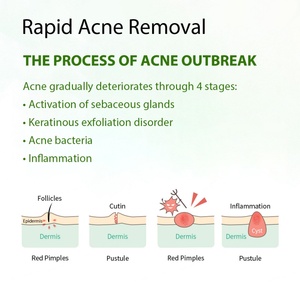 OEM ODM Private Label Soothing Hydrating <b>Moisturizing</b> Acnes Oil Control Tea Tree Facial Toner - Product Image 4