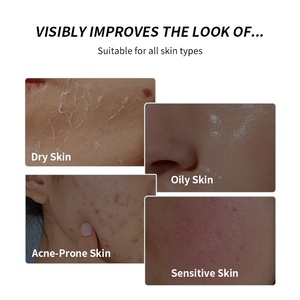 Tónico <span class=keywords><strong>Facial</strong></span> Milk Skin con 2% de Niacinamida y Extracto de Arroz, Calmante, Iluminador, con Brillo Instantáneo para Piel Seca - Product Image 5