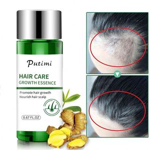 Putimi Fast Essence Shampooing <span class=keywords><strong>Anti</strong></span>-Chute pour Hommes et Femmes, Sérum de Croissance Capillaire Préventif - Product Image 2
