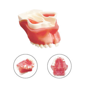 Hoogwaardig tandmodel voor onmiddellijke implantatopraktijk, geschikt voor demonstraties bij tandartsen en studententraining - Product Image 5