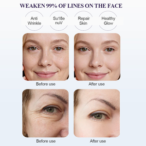 Crema Contorno de Ojos Antienvejecimiento <span class=keywords><strong>Rosina</strong></span> ODM/OEM MOQ 300 - Product Image 5