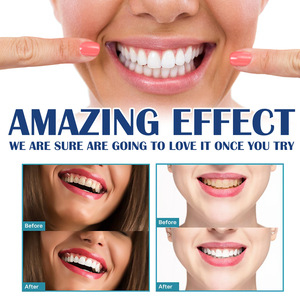 JAYSUING 5ml Multi-Purpose <strong>Teeth</strong> Whitening Instant Temporary <strong>Tooth</strong> <strong>Paint</strong> Accessory - Product Image 5