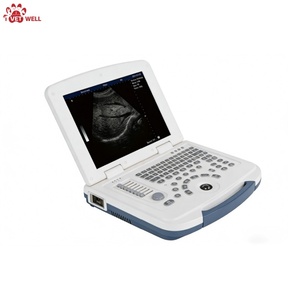 Escáner de Ultrasonido Veterinario Digital de Alta Definición, Adecuado para el Examen del Hígado, la Tripa, los Riñones, el Útero y la Vejiga de Mascotas - Product Image 2