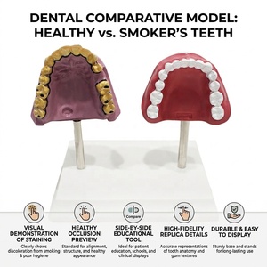 Maniquí <span class=keywords><strong>de</strong></span> PVC Ecológico para Demostración <span class=keywords><strong>de</strong></span> Dientes Saludables con Manchas <span class=keywords><strong>de</strong></span> Tabaco, para Estomatología, Higiene Bucal, Enseñanza en Laboratorio, E/ISO/ROHS/CNAS - Product Image 1