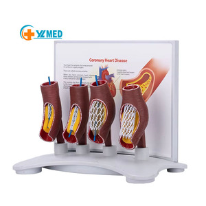 Modelo <span class=keywords><strong>de</strong></span> stent vascular <span class=keywords><strong>de</strong></span> ciencia médica modelo vascular humano enseñanza médica modelo <span class=keywords><strong>de</strong></span> <span class=keywords><strong>anatomía</strong></span> vascular <span class=keywords><strong>patológica</strong></span> - Product Image 1