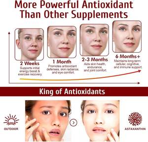 תוסף תזונה טבעי נוגד חמצון בכמוסות רכות 12 מיליגרם אסטקסנטין, כמוסות רכות לבריאות העיניים, המפרקים והעור - Product Image 6