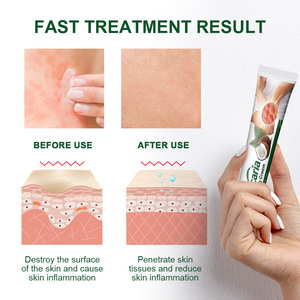 Crème anti-démangeaisons à base d'huile de noix de coco naturelle 20g pour le soin de la peau et le soulagement des démangeaisons cutanées - Product Image 6