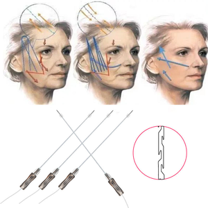 Fils PDO PCL PLLA COG de qualité supérieure pour formation, prix avantageux, pour Fox Eye 27G 60mm-100mm, esthétique médicale, formation premium - Product Image 6
