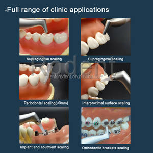 Macchina dentale lucidatrice ad aria lucidatrice ad aria dentale sabbiatrice ad aria dentale profia ad aria - Product Image 6