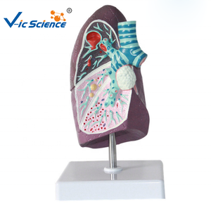 Modelo patológico de pulmón humano con enfermedades, modelo de pulmón visceral de fumador, modelo de enseñanza del sistema respiratorio - Product Image 2