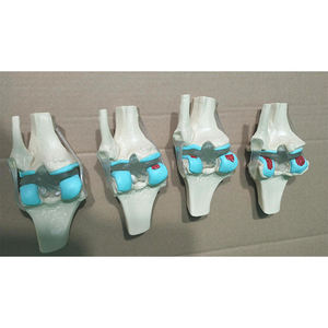Fabrieks Menselijk Skelet Anatomisch Bot Leermodel 4-Stage Zieke Kniegewrichtsmodel - Product Image 6