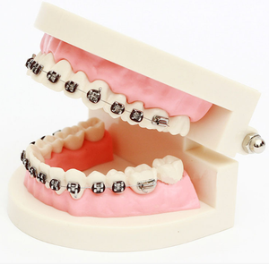 Modello Dentale Pediatrico <span class=keywords><strong>di</strong></span> Piccole Dimensioni per l'Insegnamento Odontoiatrico e l'Esposizione della Cura della Salute Orale, Modello per Trattamenti Ortodontici - Product Image 3