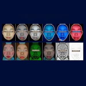 Analyseur de peau du visage, détecteur de visage 3D, nouveau modèle, analyseur de peau du visage, scanner, appareil d'esthétique en 17 langues - Product Image 5
